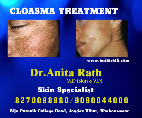 best skin treatment clinic in bhubaneswar near ayush hospital